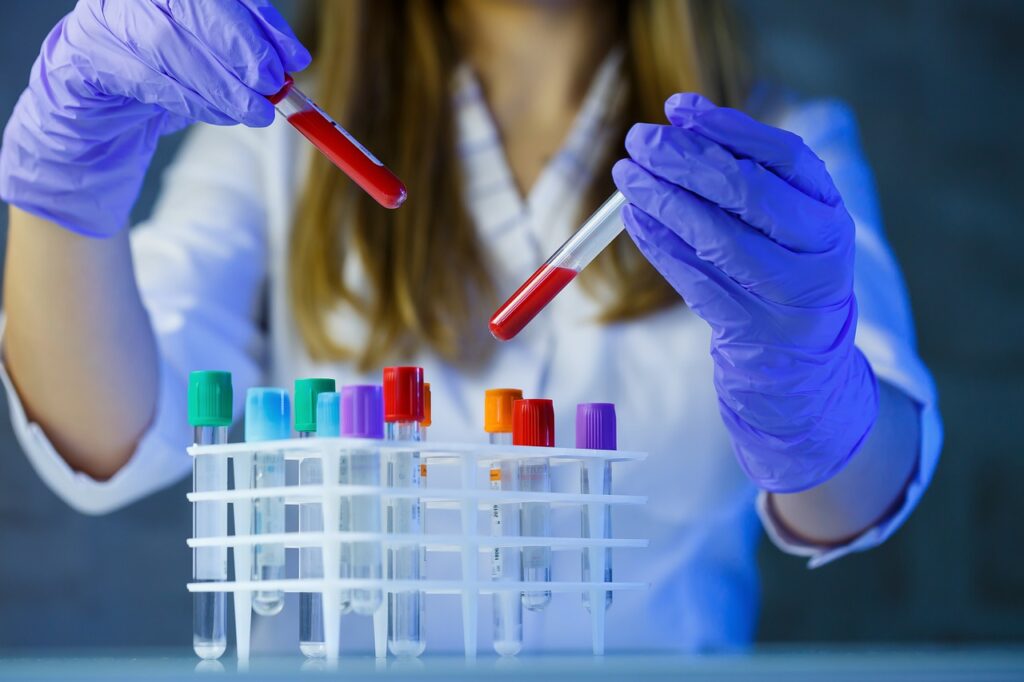 test tubes, laboratory, medical-7582098.jpg